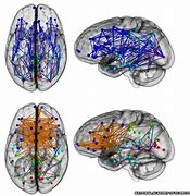 Image result for Men vs Women Brain
