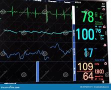 Image result for ICU Monitor Screen