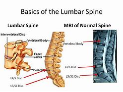 Image result for Lumbar Spinal Anatomy