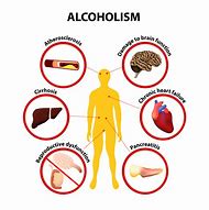 Image result for Substance Abuse and Mental Health Alcohol
