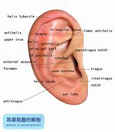 Image result for jaro-ear