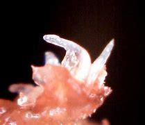 Image result for Morgellons Worms in Humans