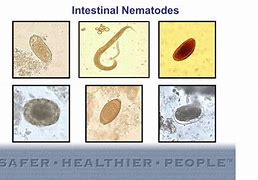 Image result for Intestinal Nematodes