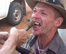 Image result for Messed Up Teeth Farmer