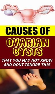 Image result for 6 Cm Ovarian Cyst