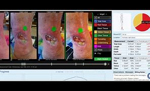 Image result for Tissue Analytics iPhone Screen Shot