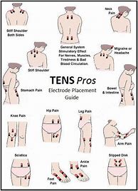 Image result for Tens Unit Electrode Placement
