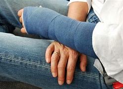 Image result for Women with Broken Arm