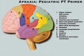 Image result for apraxia