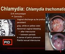 Image result for Chlamydia Trachomatis Discharge Color