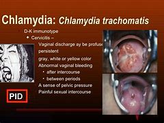 Image result for What Do Chlamydia Look Like