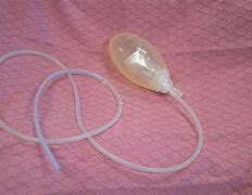 Image result for Chest Tube Drainage System