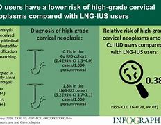 Image result for Copper IUD Side Effects