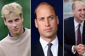 Image result for Prince William Before and After