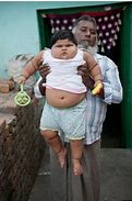 Image result for Fattest Baby