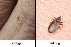 Image result for Chiggers vs Bed Bugs