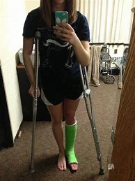 Image result for Her Broken Foot Cast