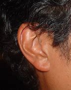Image result for Open Ear Hearing Aids