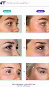 Image result for Cat Eyebrow Lift