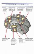Image result for Pictures of Shrinking Brain