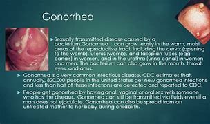 Image result for Ghonnerah