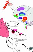 Image result for Little Brain in the Heart