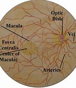 Image result for Right Eye Retina