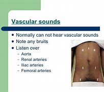 Image result for Vascular Bruits