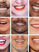 Image result for American Smile