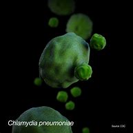 Image result for Gram-negative Chlamydia