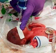 Image result for Smallest Baby