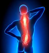 Image result for Symptoms of Spinal Misalignment