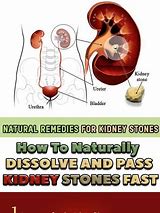 Image result for 4Mm Kidney Stone