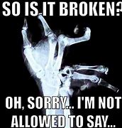 Image result for Funny Wrist X-Ray