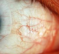 Image result for Sclera Under Microscope