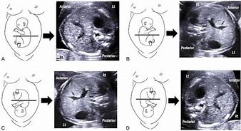 Image result for Poster Presentation Fetal Ultrasound