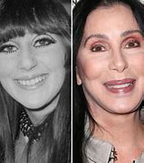Image result for Cher Surgery