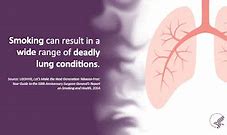 Image result for Malignant Lung Tumor