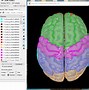 Image result for Detailed Brain Anatomy
