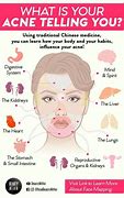 Image result for breakouts cause