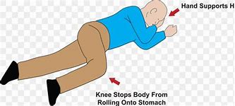 Image result for W-shape Recovery Postion Cartoon