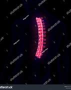 Image result for Spinal Cord Vertebral Column