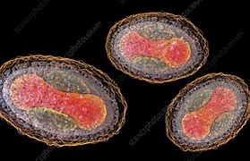 Image result for Deoxyribonucleic Acid Virus Molluscum Contagiosum