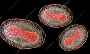 Image result for Molluscum Contagiosum Virus Morphology