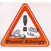 Image result for Peanut Allergy Alert Sign