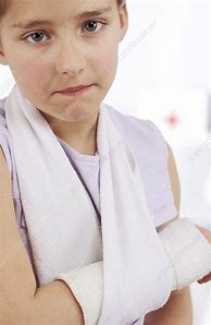 Image result for Girl with Broken Arm