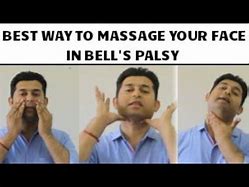 Image result for Bell's Palsy Facial Massage