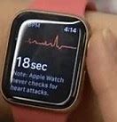 Image result for Apple Watch 4 Grid Studio