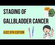 Image result for Gallbladder Cancer Staging