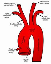 Image result for Carotid Artery in Neck